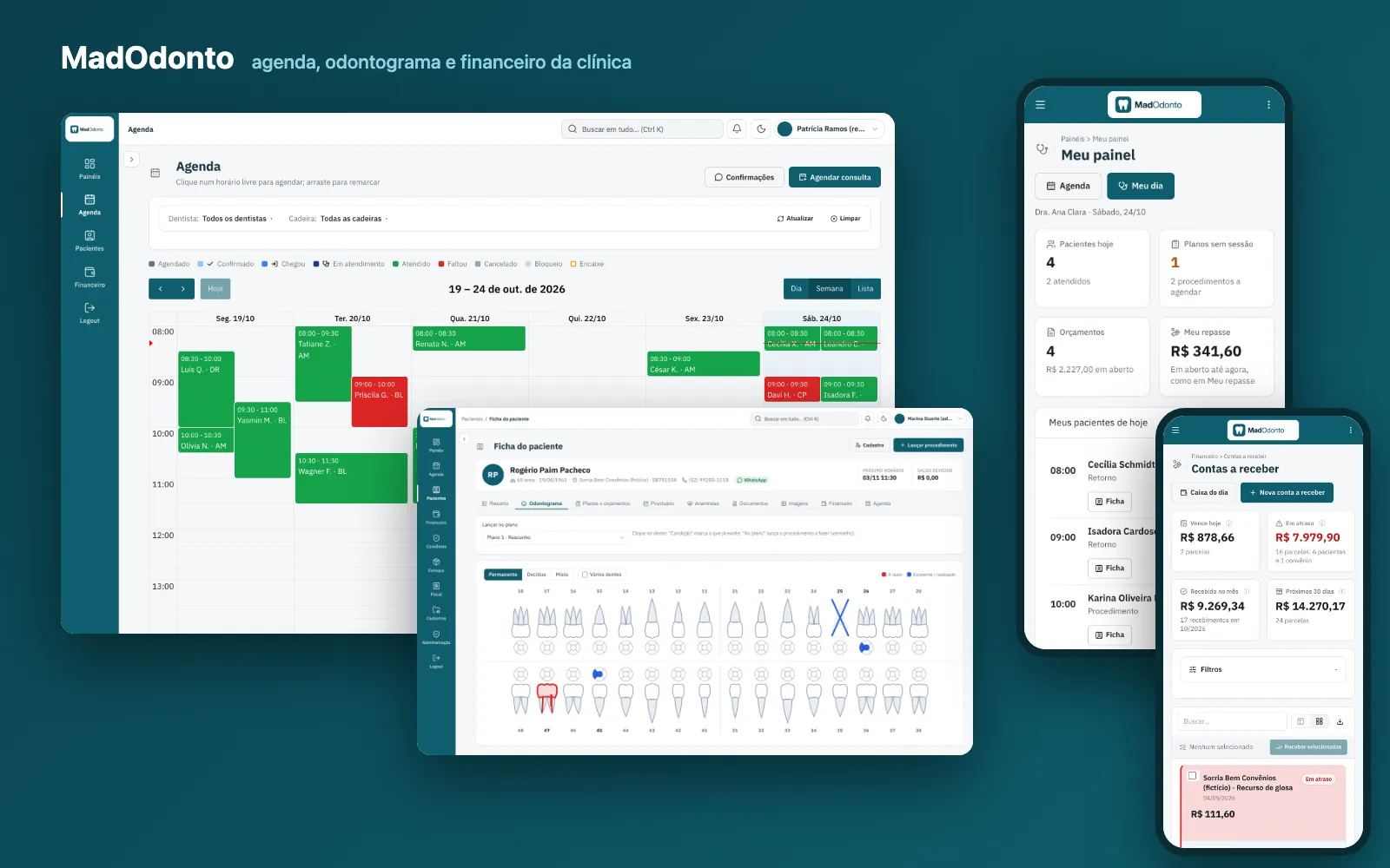 Software para clínica dental MadOdonto: agenda de la semana por odontólogo, odontograma de la ficha del paciente y el panel del odontólogo y las cuentas por cobrar en el celular
